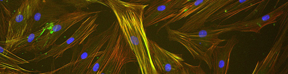 tratamentul prostatitei conform lui dmitry kharitonov traitement hyperplasie prostate chien